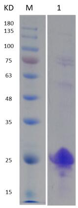 12% SDS-PAGE analysis profiles of purified MCR_RS00780-28-181 (CBB stained).